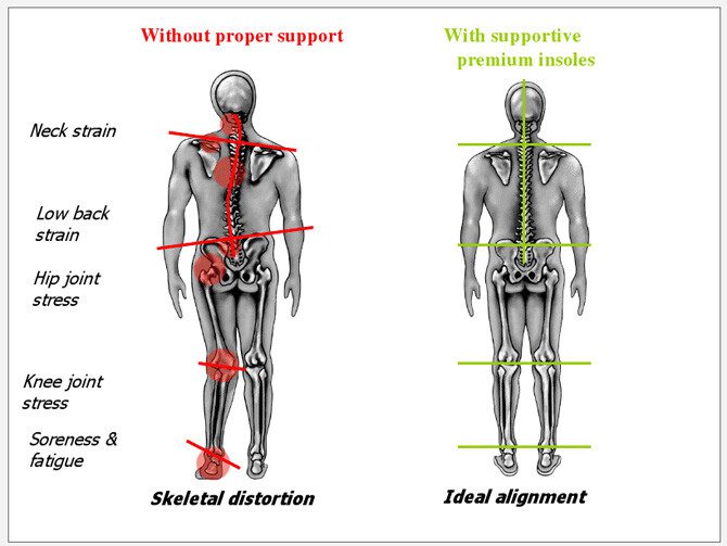 Superfoot supportchart Improved body alignment and balance  