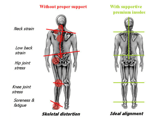 Custom insoles in near - Compare Body structure image between Premium supportive insoles and not support insoles.