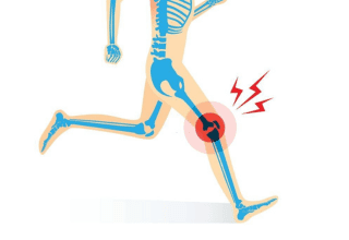Leg Bone pain image